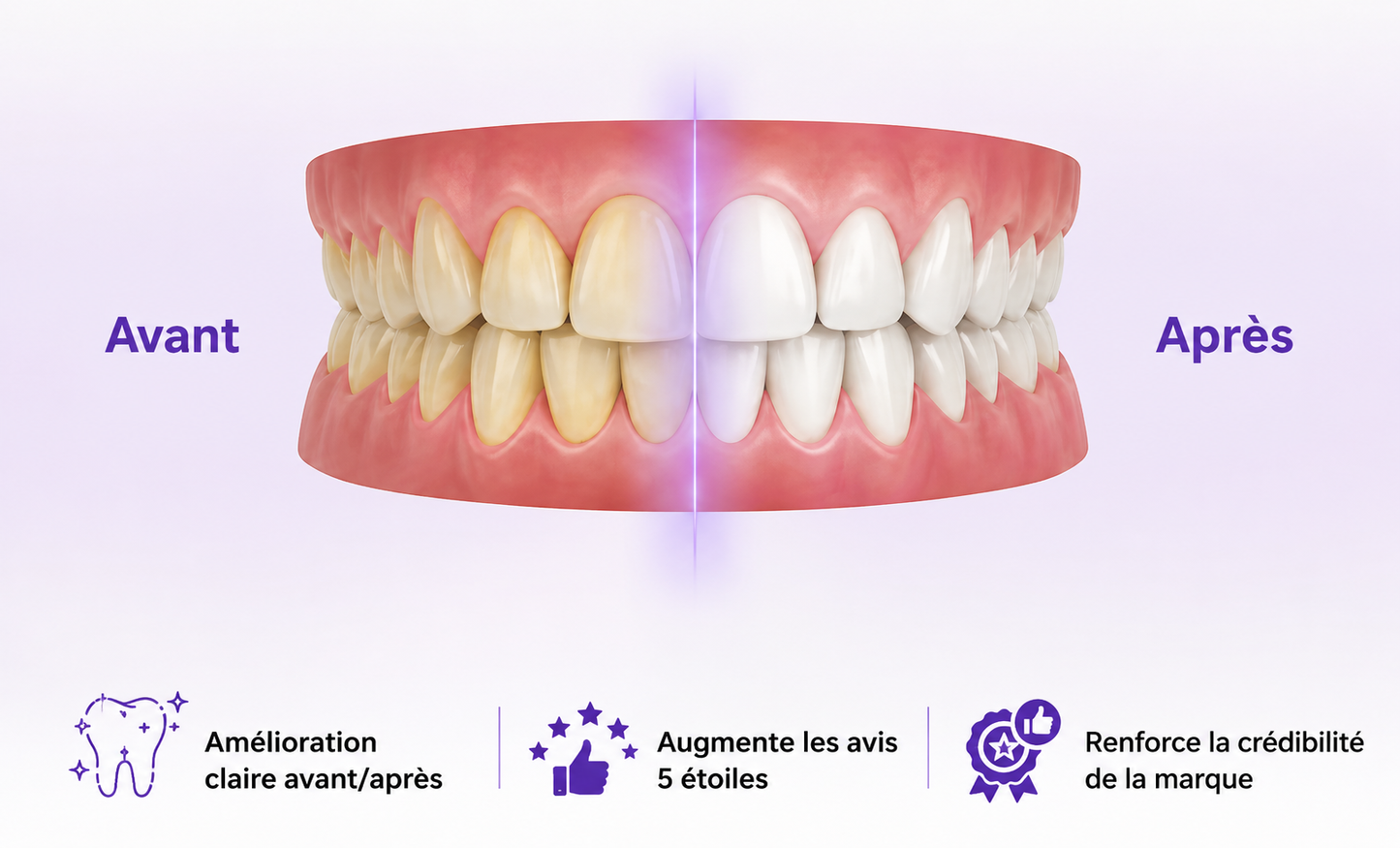 ✨ 𝑩𝒂𝒏𝒅𝒆 𝒅𝒆 𝑩𝒍𝒂𝒏𝒄𝒉𝒊𝒎𝒆𝒏𝒕 𝑫𝒆𝒏𝒕𝒂𝒊𝒓𝒆 🦷
